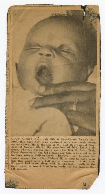 Sam Ringgold Jr. born with a tooth